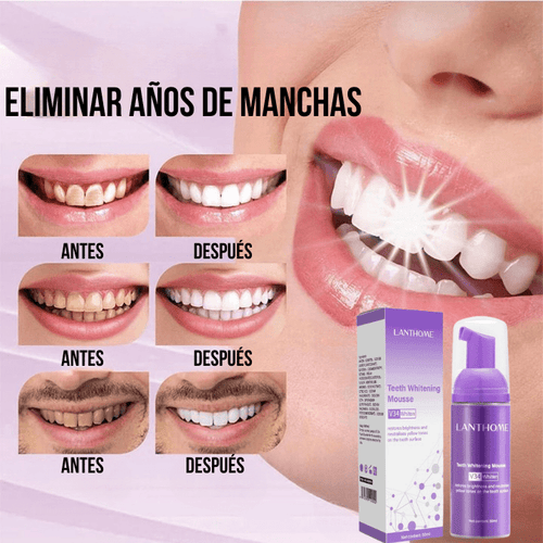 BLANQUEAMIENTO DENTAL LANTHOME FRESH WHITE [RESULTADO PROBADO]